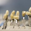 Wybielanie zębów u stomatologa